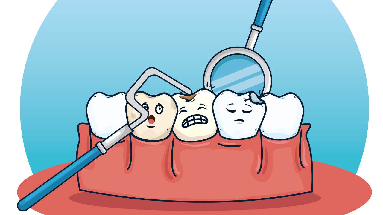 The Carious Cavity - Disease & Treatment